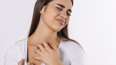 Eczema